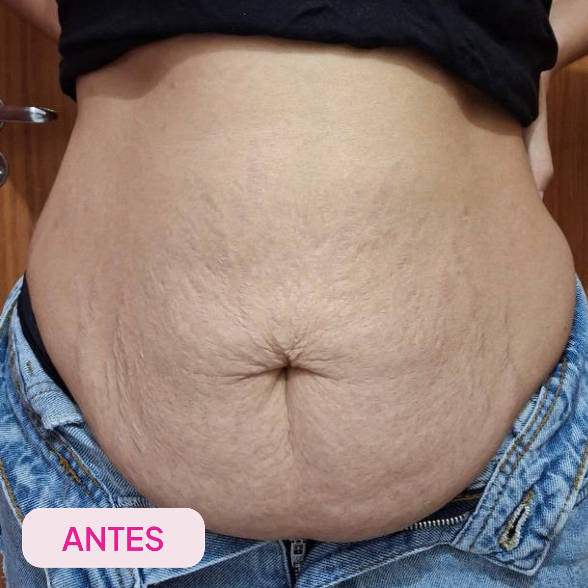 Imagem de antes apresentada pela marca